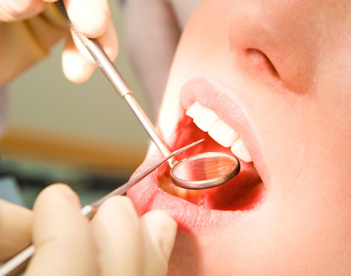 A kick in the teeth: Dental care prices to rise 4% 